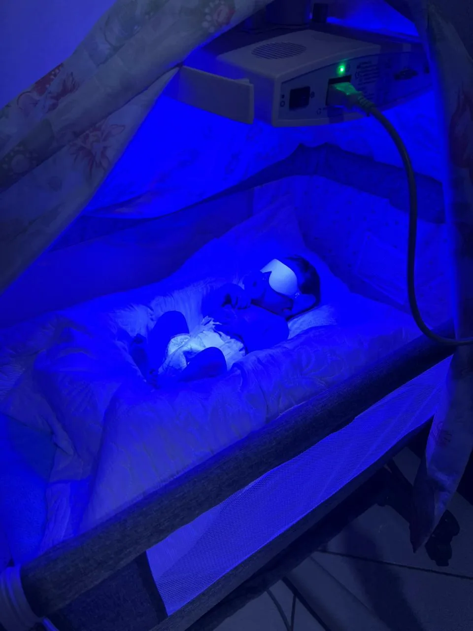 Bebê em tratamento sob a luz azul do equipamento profissional de fototerapia Fanem BiliTron em casa