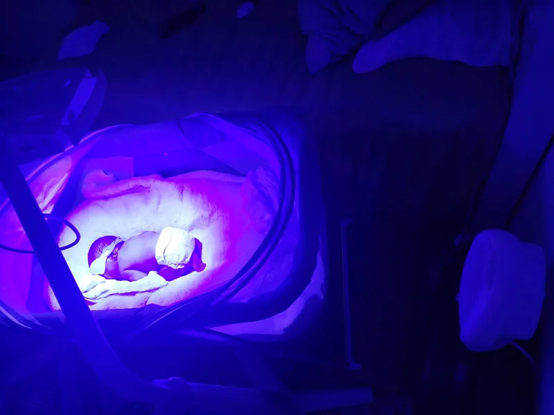 Bebê em tratamento de fototerapia neonatal domiciliar