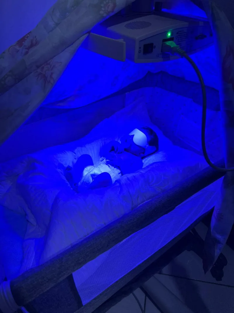 Recém-nascido em berço com equipamento de fototerapia