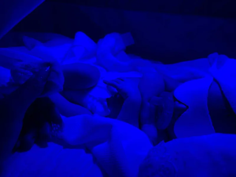 Detalhe do bebê sob luz azul de fototerapia