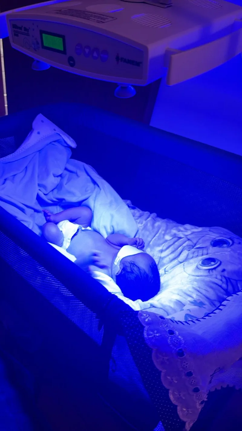 Bebê em fototerapia com equipamento profissional Fanem