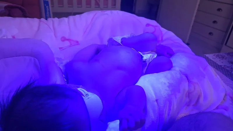 Atendimento humanizado de fototerapia em casa
